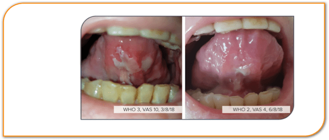 B-Cure Late Effects Pro - Image 2